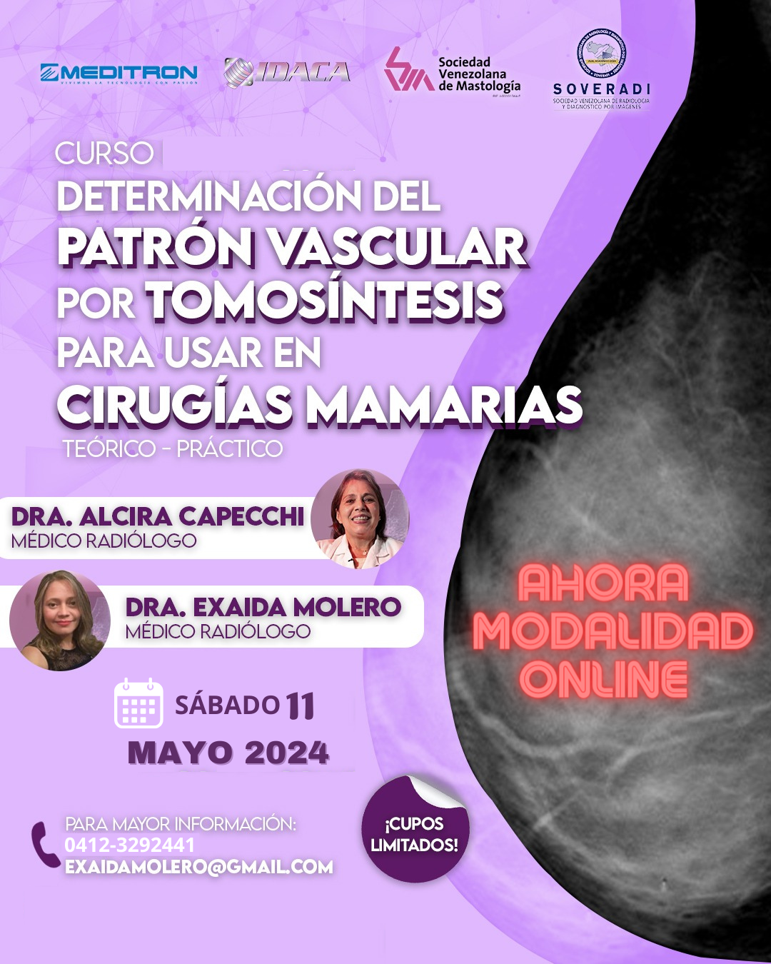 Curso Online Determinación del Patrón Vascular para usar en Cirugías mamarias